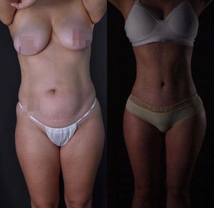 PHOTO-2024-08-30-20-19-22 (4)