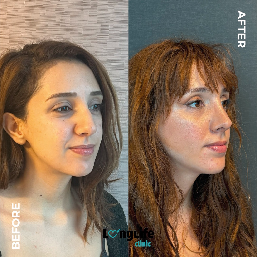 PHOTO-2024-08-30-20-35-36 (5)